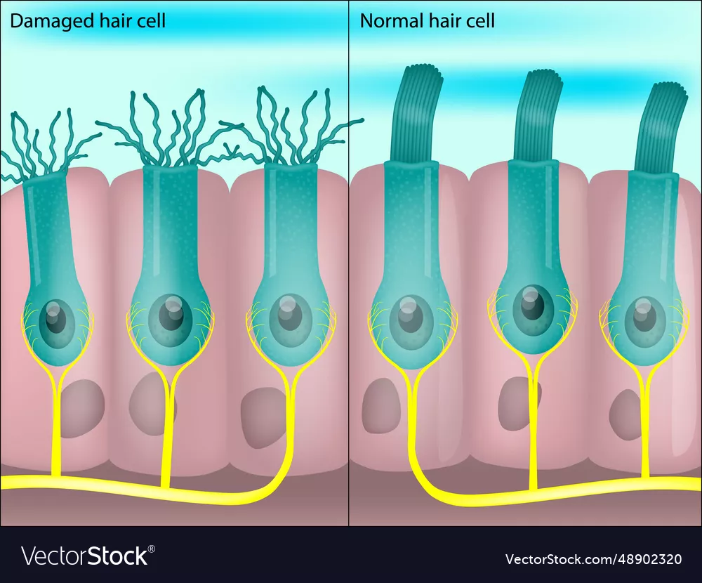 Health and Damaged Hearing Hair Cells